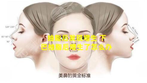 抽脂后发现增生 下巴抽脂后增生了怎么办